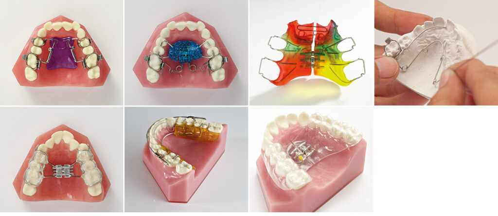 Indirect bonding - JJ Thompson Orthodontic Appliances